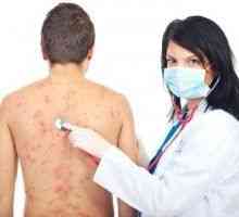 Алергичен към кожата, алергични кожни обриви