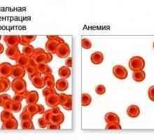 Анемия на кръвта, което води до анемия, кръв?