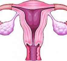 Яйчниците апоплексия - симптоми, лечение, бременност след яйчниците апоплексия