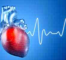 Сърдечна аритмия: симптоми, лечение