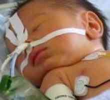 Artreziya хранопровода при новородени
