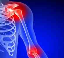 Остеоартритът на раменната става: симптоми и лечение