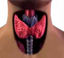 Автоимунните тиреоидит на щитовидната жлеза