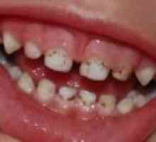 Какво да правите, ако детето ви плака по зъбите?