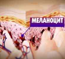 Какво да се направи в меланом: откриване, методи за лечение, използването на имунотерапия