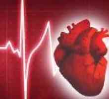 Какво е нарушен сърдечен ритъм?