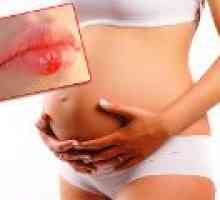 Херпес по време на бременност - независимо дали това е опасно?