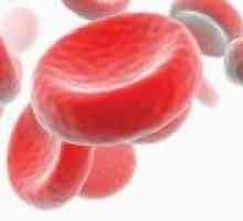 Хипохромна анемия: Видове и лечение
