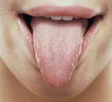 Глосит - възпаление на езика