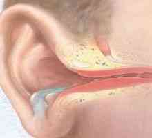 Гнойни възпаления на средното ухо - средна, остра, хронична, гнойни отити при деца, лечение