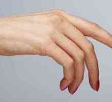 Студени ръце на една жена са естествен фактор!