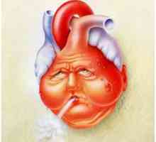 Хронична сърдечна недостатъчност