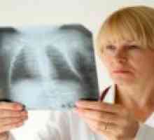 Хроничното възпаление на белите дробове: Симптоми, Лечение