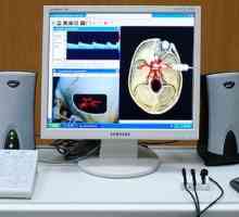 Използване на плавателни съдове триплекс сканиране врата и мозъка