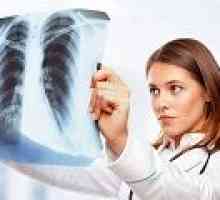 Хидатидна заболяване на белите дробове, какво е това?
