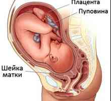 Шийката на матката ерозия и бременност