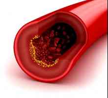 Колко бързо за намаляване на холестерола народни средства