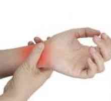 Как за лечение на изкълчване на ръката?