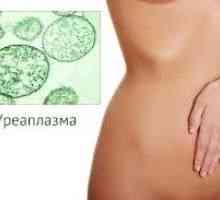 Лечение на Ureaplasma при жените, при мъжете