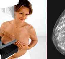 Мамография на гърдата