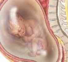 Polyhydramnios време на бременност, причини, последствия