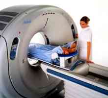 MRI на белия дроб: Когато се кандидатства?