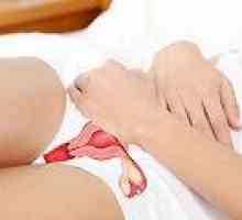 Запушване на влагалището и шийката на матката: основното лечение