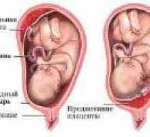 Ниско на плацентата по време на бременност, какво е това?