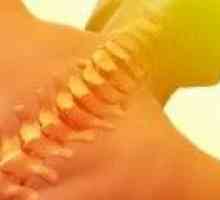 Остеохондроза на гръбнака в гръдния
