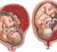 Отлепване на плацентата и в ранна бременност