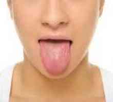 Защо вцепенен език, на върха на езика? причини