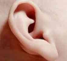 Защо вцепенен ухото? причини