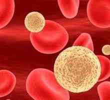 Ниски кръвни левкоцити: причини и лечение