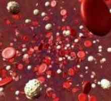 Увеличен брой на тромбоцитите в кръвта