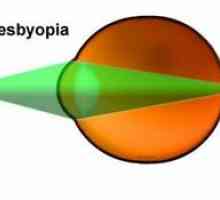 Пресбиопията око