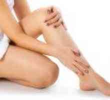 Причини за възникване на отоци по краката при жените