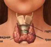 Признаци на заболявания на щитовидната жлеза