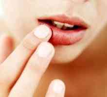 А пъпка на устните: как да се отърве от причините за