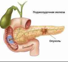Рак на панкреаса: ранни симптоми
