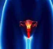 Рак на влагалището при жените - причини, диагностика, лечение