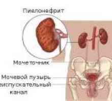 Симптомите на хроничен пиелонефрит при жените, при мъжете