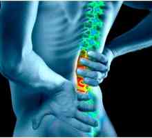 Симптомите на притискане на нерв в долната част на гърба и лечението