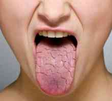Сухотата в устата - причинява заболяване,