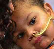 Тригодишен момче трансплантирани в същото време на петте органи донори