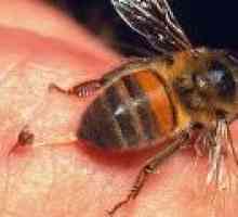 Пчелното жило, оса, стършел: Процедури
