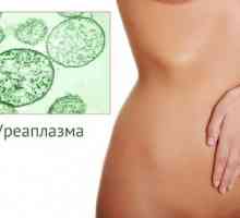 Ureaplasma в жените - симптоми и лечение