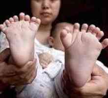 В Китай, едно дете е родено с 31 пръста