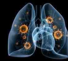 Вирусна пневмония - причини, симптоми, диагностика и лечение