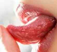 Възпаление на езика, причини и лечение