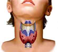 Заболявания на щитовидната жлеза при жените
